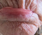 Nelson_Irmi_01_Lower Lip_